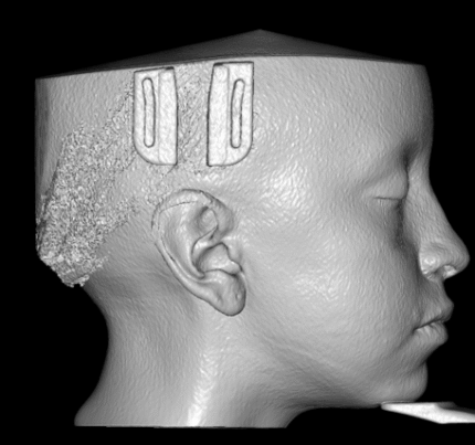 tomografia dental cbct